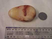 jupiters_bladder_stone